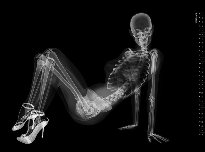 Скелет рентген