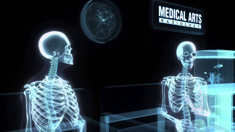 Скелет рентген