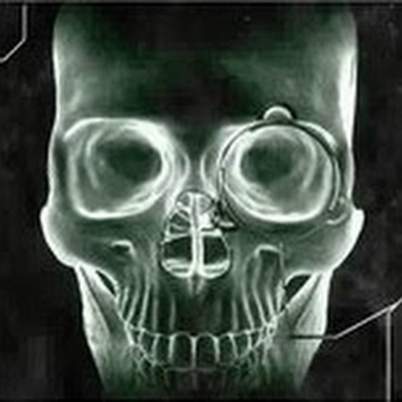 Рентгеновский снимок