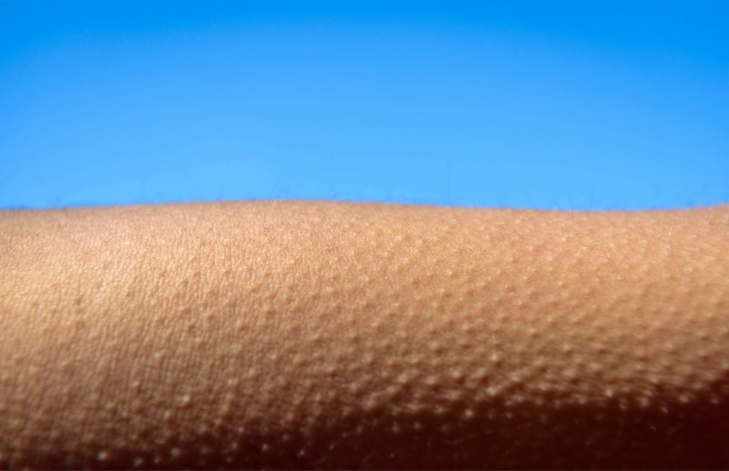 Мурашки на коже