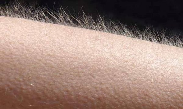 Фолликулярный Каритас