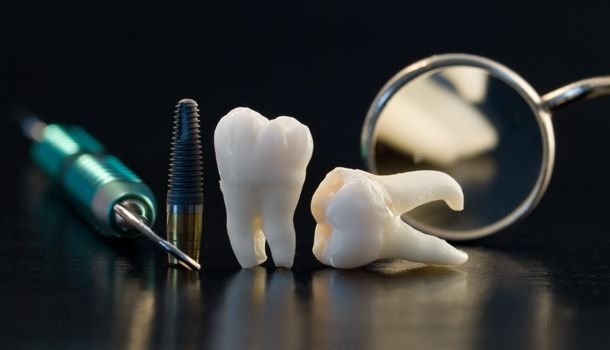 Стоматология зубы